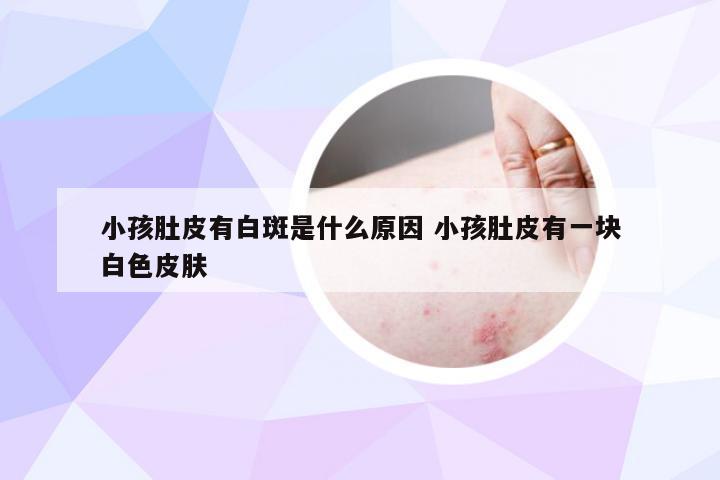 小孩肚皮有白斑是什么原因 小孩肚皮有一块白色皮肤