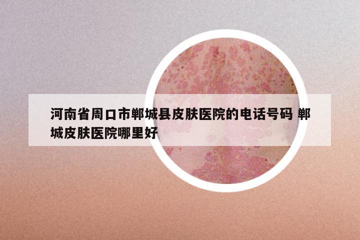 河南省周口市郸城县皮肤医院的电话号码 郸城皮肤医院哪里好