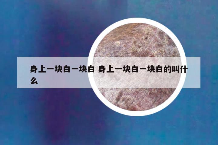 身上一块白一块白 身上一块白一块白的叫什么