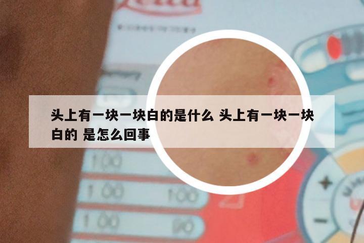 头上有一块一块白的是什么 头上有一块一块白的 是怎么回事