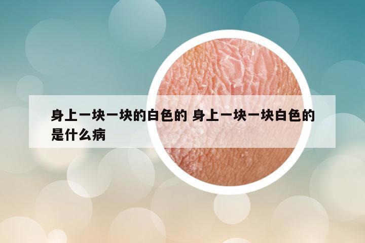 身上一块一块的白色的 身上一块一块白色的是什么病
