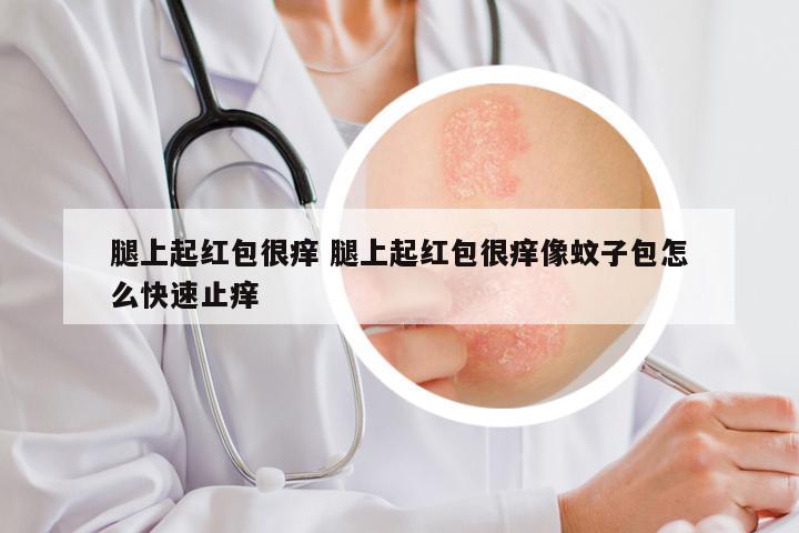 腿上起红包很痒 腿上起红包很痒像蚊子包怎么快速止痒