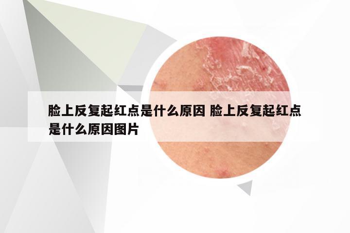 脸上反复起红点是什么原因 脸上反复起红点是什么原因图片