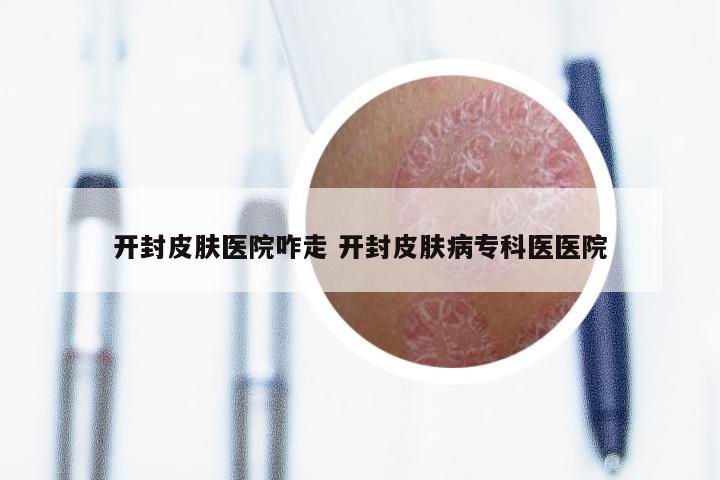 开封皮肤医院咋走 开封皮肤病专科医医院