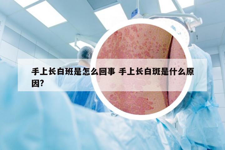 手上长白班是怎么回事 手上长白斑是什么原因?