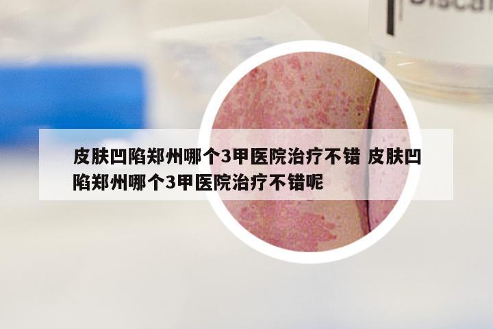 皮肤凹陷郑州哪个3甲医院治疗不错 皮肤凹陷郑州哪个3甲医院治疗不错呢