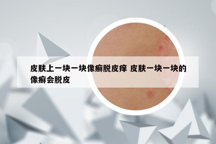 皮肤上一块一块像癣脱皮痒 皮肤一块一块的像癣会脱皮