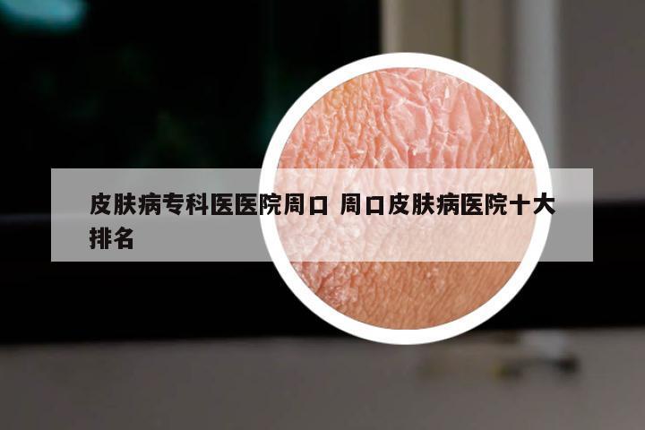 皮肤病专科医医院周口 周口皮肤病医院十大排名