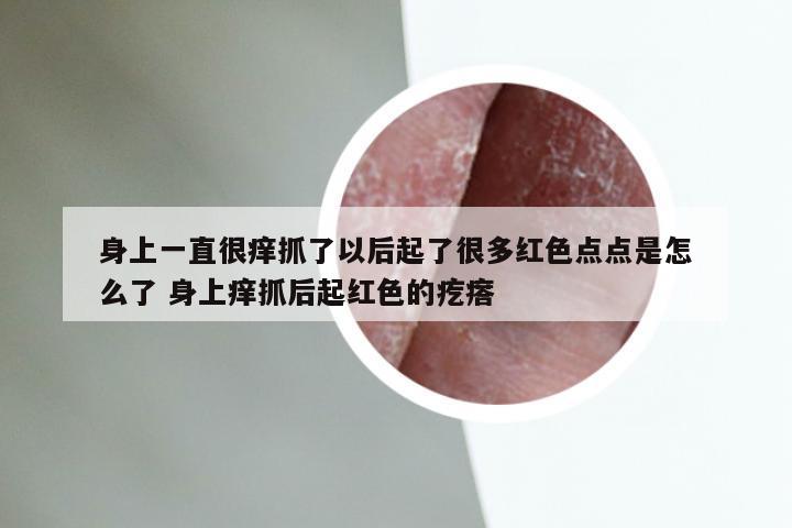 身上一直很痒抓了以后起了很多红色点点是怎么了 身上痒抓后起红色的疙瘩
