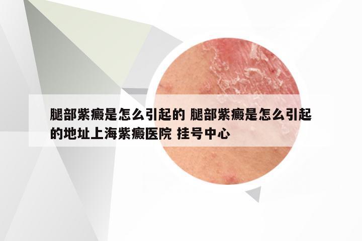 腿部紫癜是怎么引起的 腿部紫癜是怎么引起的地址上海紫癜医院 挂号中心