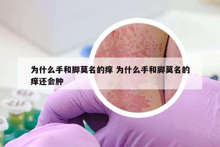 为什么手和脚莫名的痒 为什么手和脚莫名的痒还会肿