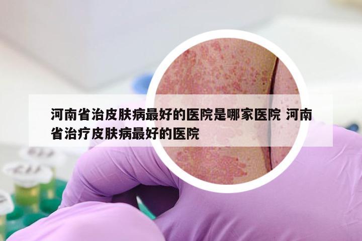 河南省治皮肤病最好的医院是哪家医院 河南省治疗皮肤病最好的医院