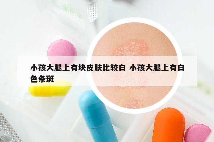 小孩大腿上有块皮肤比较白 小孩大腿上有白色条斑