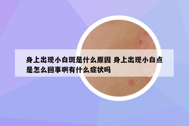 身上出现小白斑是什么原因 身上出现小白点是怎么回事啊有什么症状吗