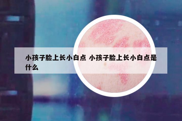 小孩子脸上长小白点 小孩子脸上长小白点是什么