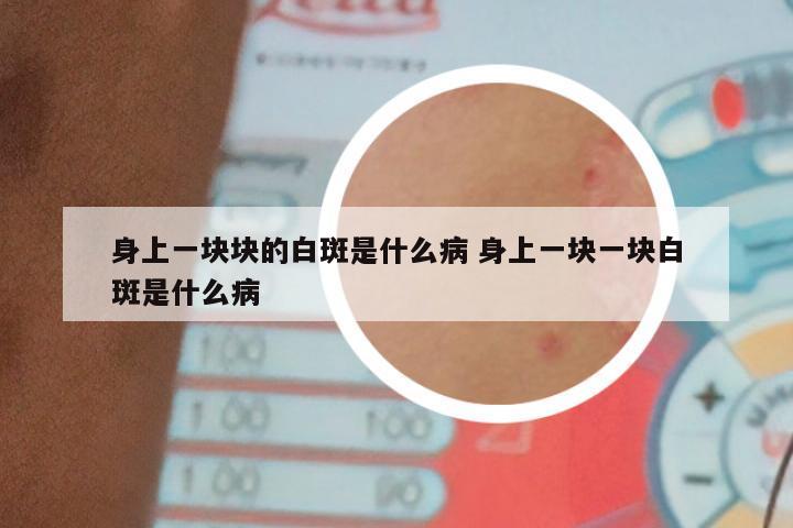 身上一块块的白斑是什么病 身上一块一块白斑是什么病