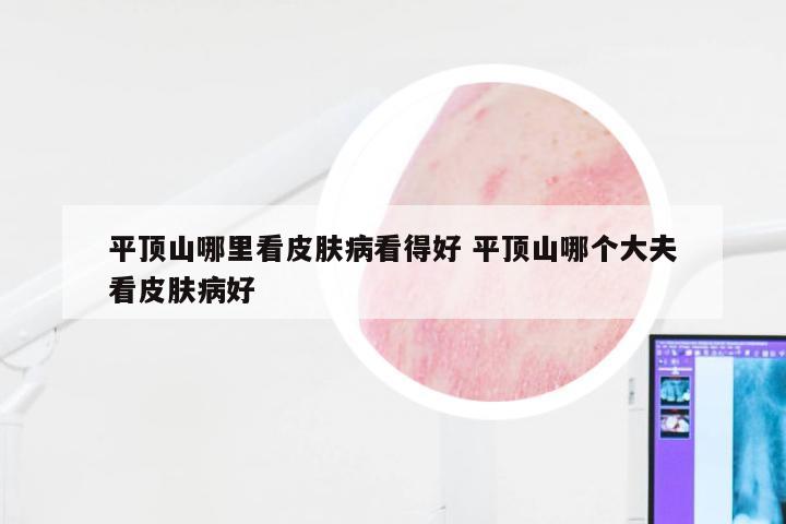 平顶山哪里看皮肤病看得好 平顶山哪个大夫看皮肤病好