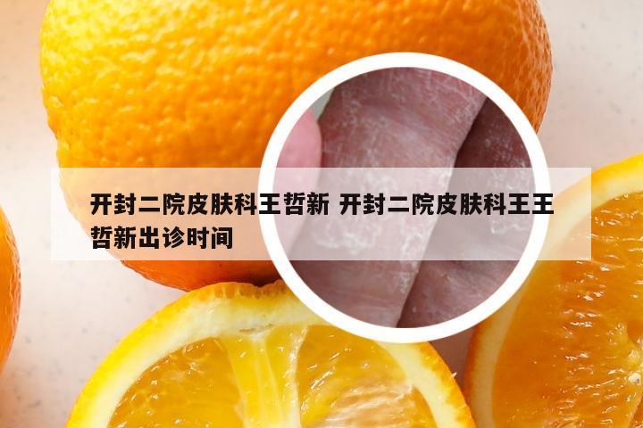 开封二院皮肤科王哲新 开封二院皮肤科王王哲新出诊时间