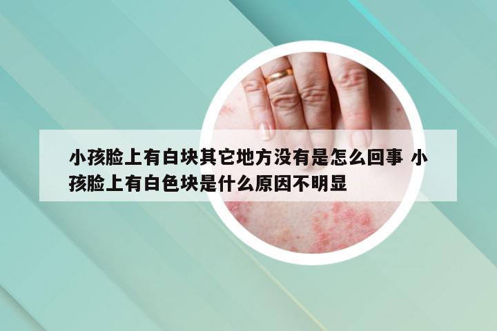 小孩脸上有白块其它地方没有是怎么回事 小孩脸上有白色块是什么原因不明显