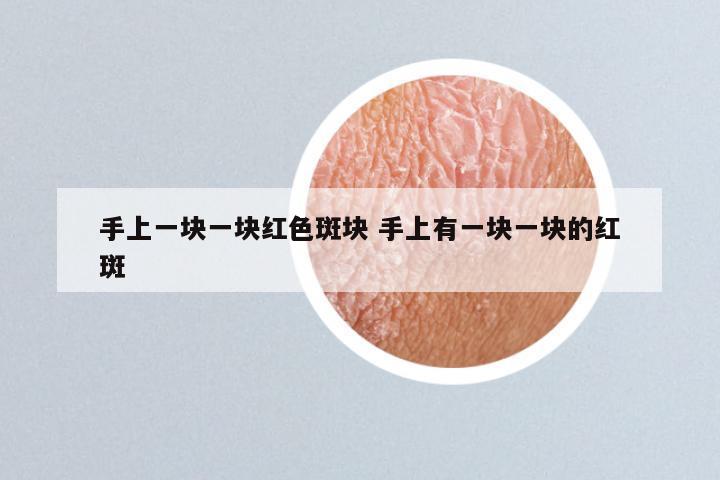 手上一块一块红色斑块 手上有一块一块的红斑