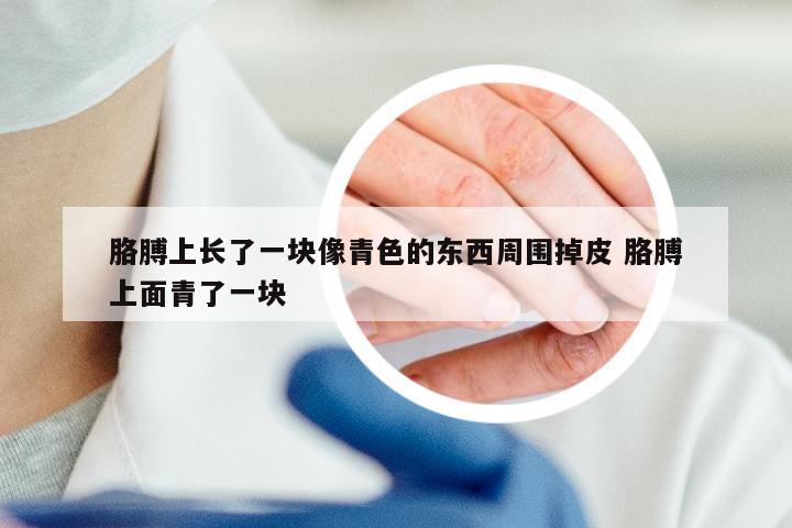 胳膊上长了一块像青色的东西周围掉皮 胳膊上面青了一块