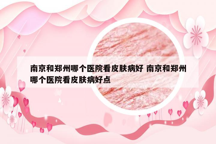 南京和郑州哪个医院看皮肤病好 南京和郑州哪个医院看皮肤病好点