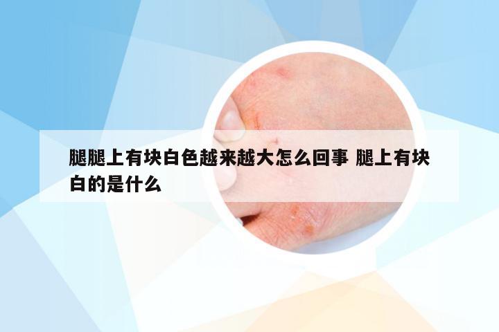 腿腿上有块白色越来越大怎么回事 腿上有块白的是什么