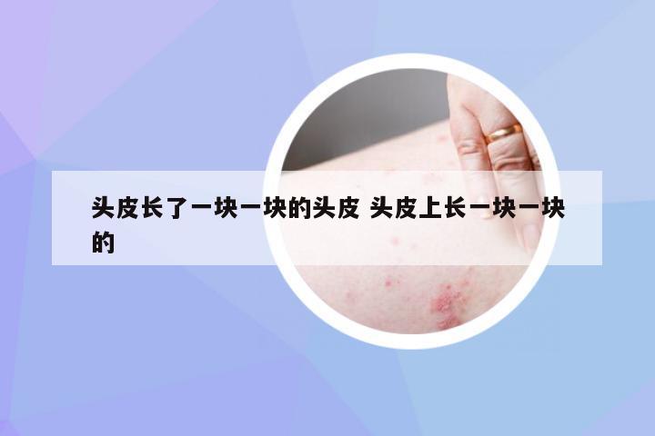头皮长了一块一块的头皮 头皮上长一块一块的