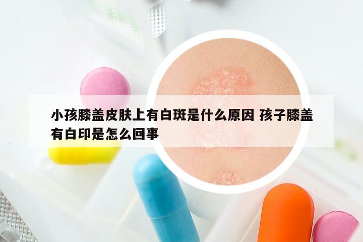 小孩膝盖皮肤上有白斑是什么原因 孩子膝盖有白印是怎么回事