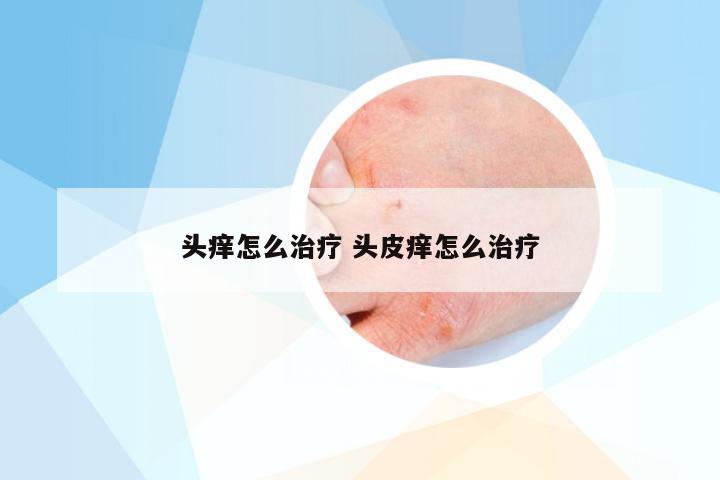 头痒怎么治疗 头皮痒怎么治疗
