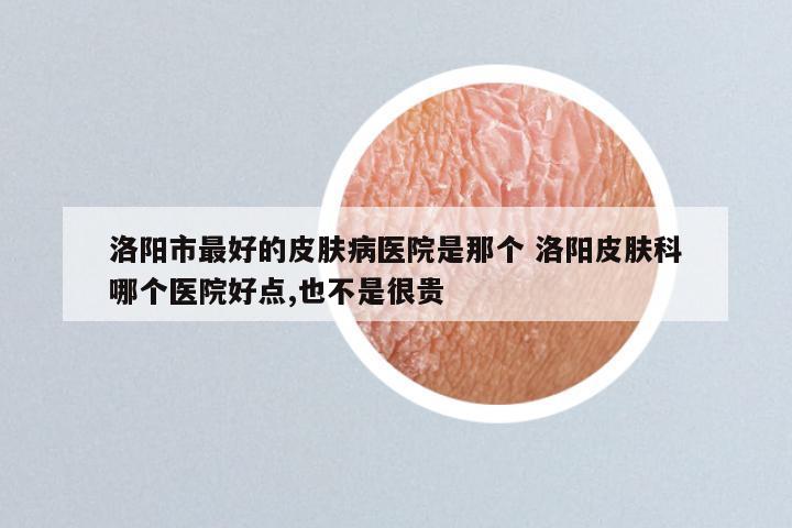 洛阳市最好的皮肤病医院是那个 洛阳皮肤科哪个医院好点,也不是很贵