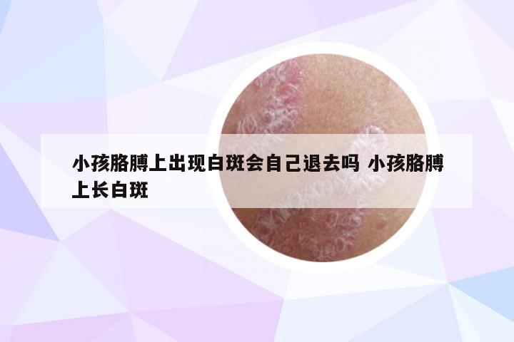 小孩胳膊上出现白斑会自己退去吗 小孩胳膊上长白斑