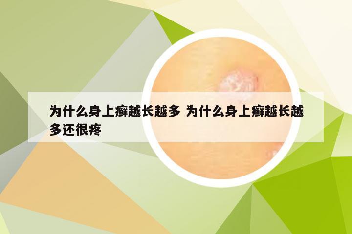为什么身上癣越长越多 为什么身上癣越长越多还很疼