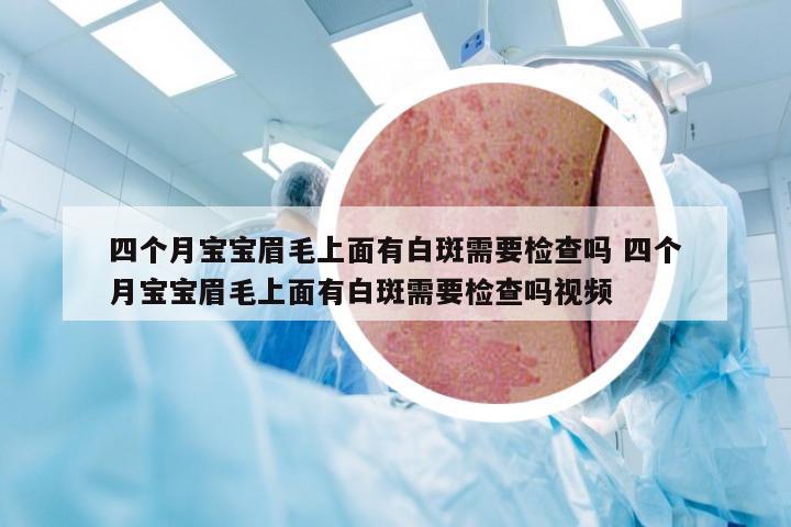 四个月宝宝眉毛上面有白斑需要检查吗 四个月宝宝眉毛上面有白斑需要检查吗视频