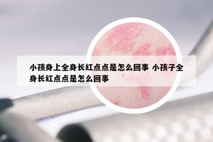 小孩身上全身长红点点是怎么回事 小孩子全身长红点点是怎么回事