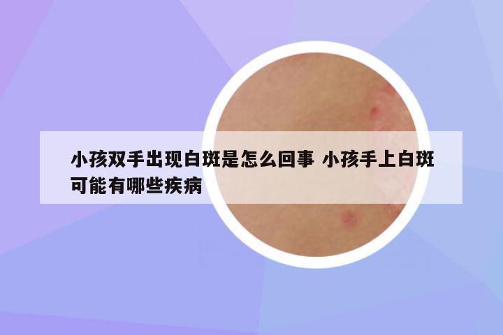 小孩双手出现白斑是怎么回事 小孩手上白斑可能有哪些疾病