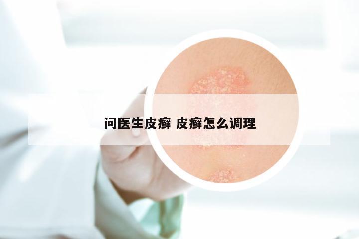 问医生皮癣 皮癣怎么调理