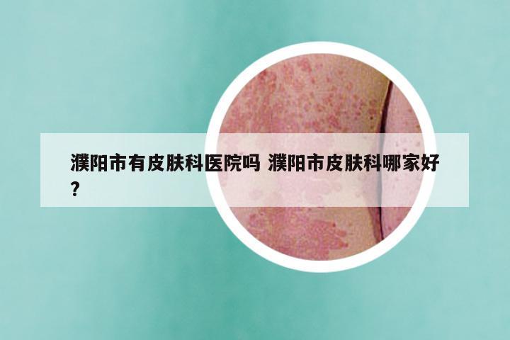 濮阳市有皮肤科医院吗 濮阳市皮肤科哪家好?