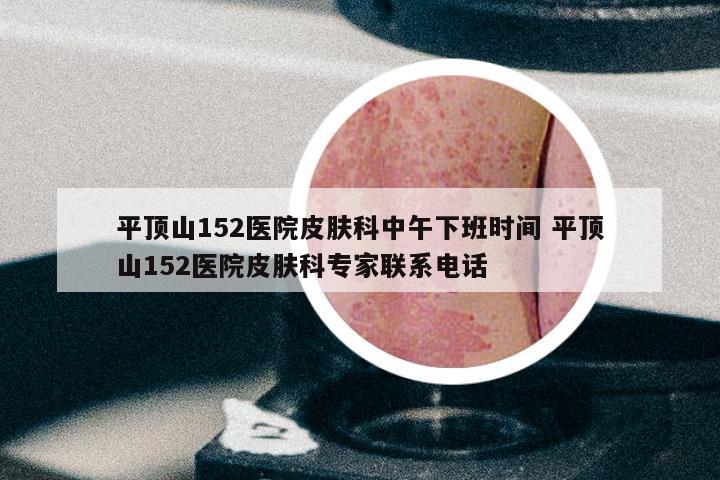 平顶山152医院皮肤科中午下班时间 平顶山152医院皮肤科专家联系电话