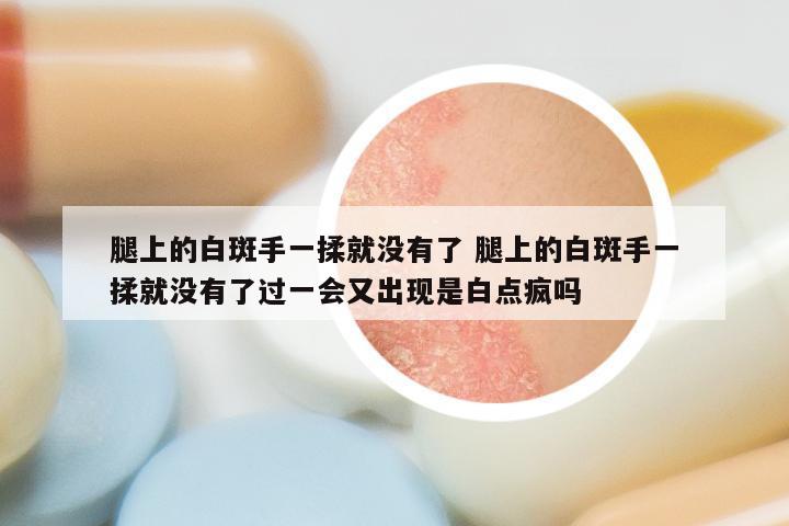 腿上的白斑手一揉就没有了 腿上的白斑手一揉就没有了过一会又出现是白点疯吗
