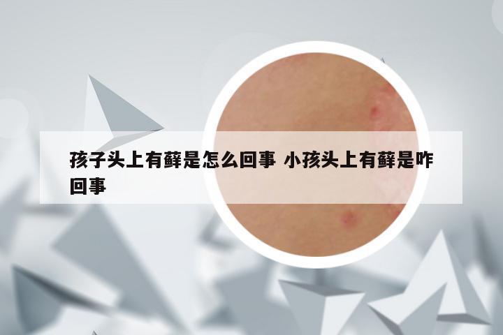 孩子头上有藓是怎么回事 小孩头上有藓是咋回事