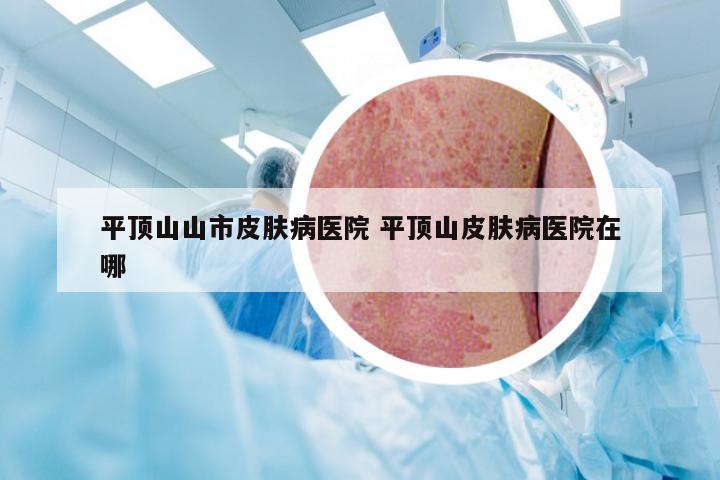 平顶山山市皮肤病医院 平顶山皮肤病医院在哪