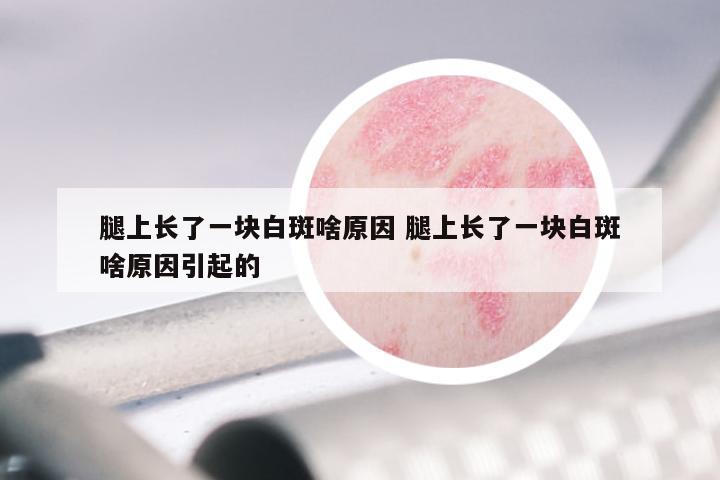 腿上长了一块白斑啥原因 腿上长了一块白斑啥原因引起的