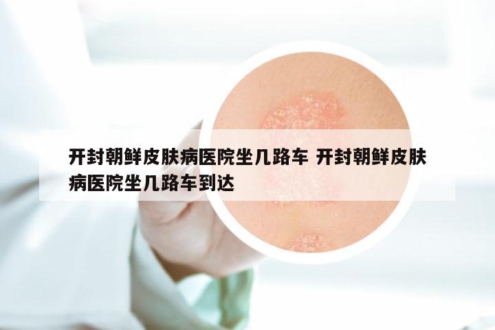 开封朝鲜皮肤病医院坐几路车 开封朝鲜皮肤病医院坐几路车到达