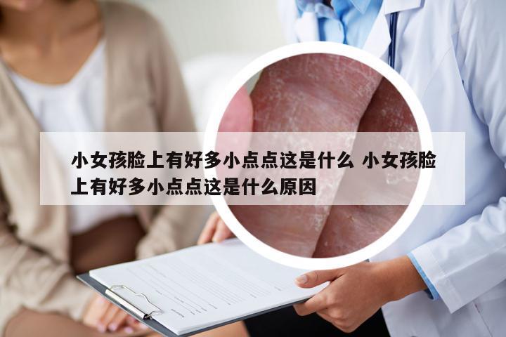 小女孩脸上有好多小点点这是什么 小女孩脸上有好多小点点这是什么原因