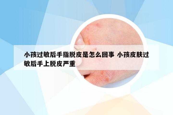 小孩过敏后手指脱皮是怎么回事 小孩皮肤过敏后手上脱皮严重