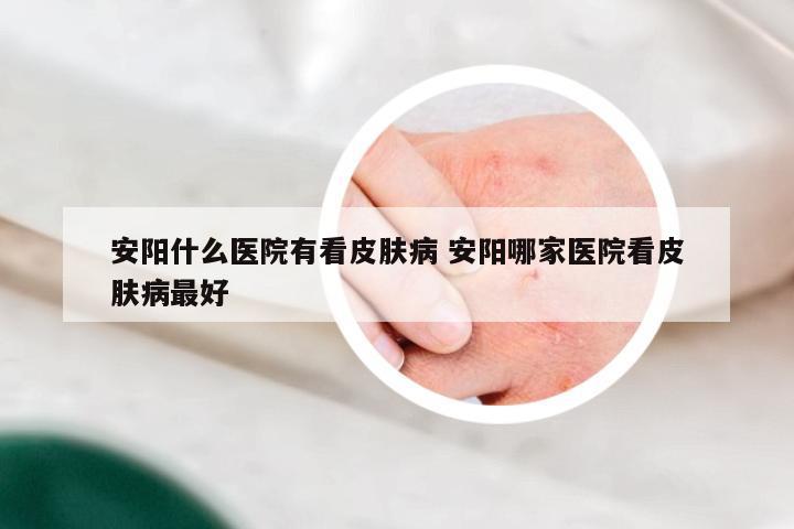 安阳什么医院有看皮肤病 安阳哪家医院看皮肤病最好