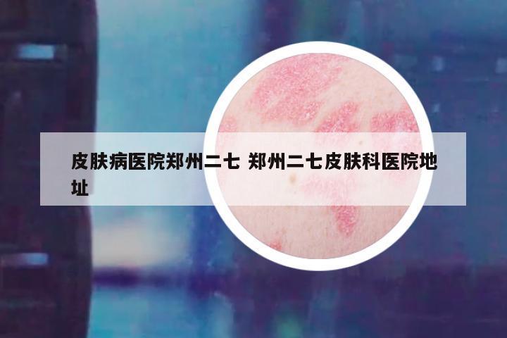 皮肤病医院郑州二七 郑州二七皮肤科医院地址