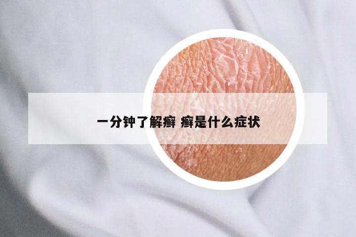 一分钟了解癣 癣是什么症状