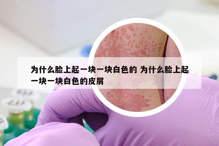 为什么脸上起一块一块白色的 为什么脸上起一块一块白色的皮屑